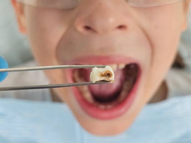 Best Broken Tooth Emergency  in Lebanon, IL